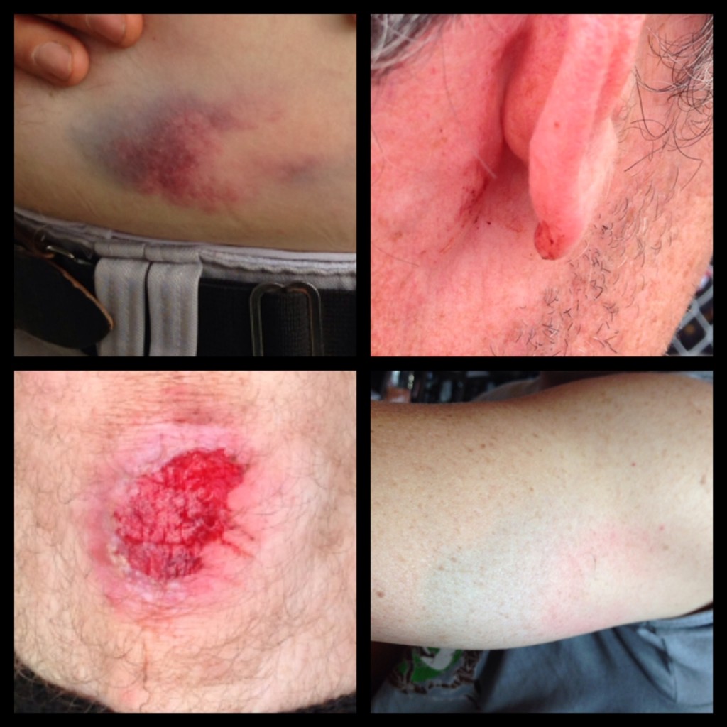 2014game09pain